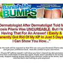 Banish My Bumps Secret