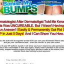 Banish My Bumps By Angela Steinberg