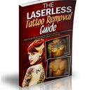 Laserless Tattoo Removal Guide PDF